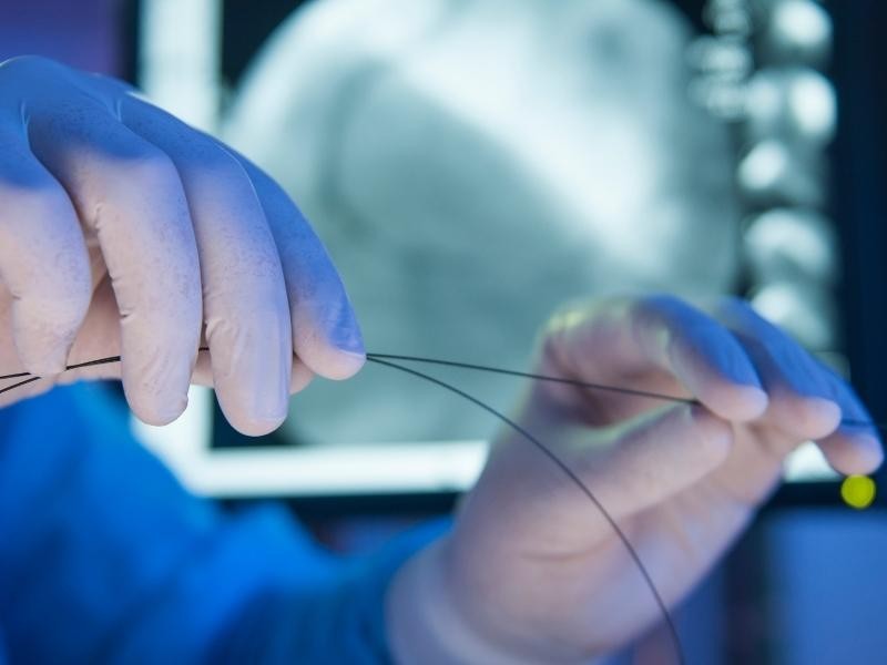 Angioplastia mesentérica