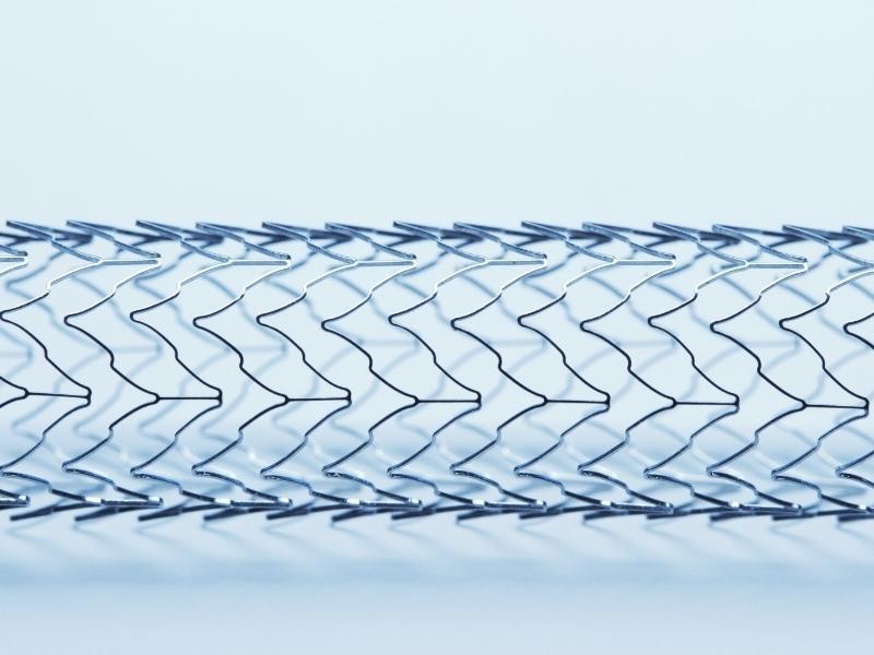 Angioplastia venosa