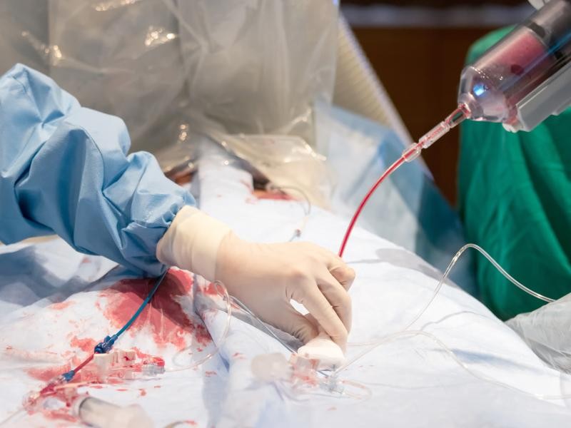 Angioplastia coronoraniana com implante de stent farmacológico