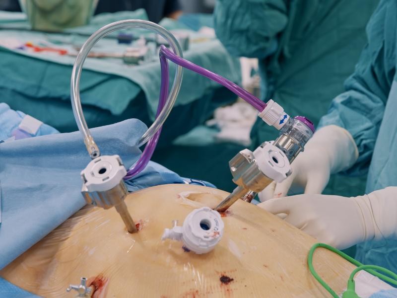 Colecistectomia por vídeo-laparoscopia