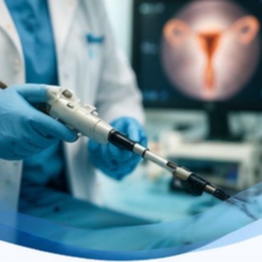 Alcoolização de Endometriomas Ovarianos em Pindamonhangaba