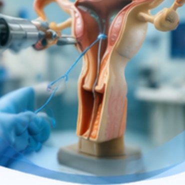 Recanalização de Tubas Uterinas em Pindamonhangaba